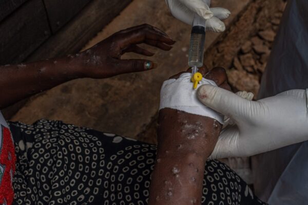 Mpox : les premiers vaccins vont arriver en RDC "ces prochains jours" (chef de l'OMS)